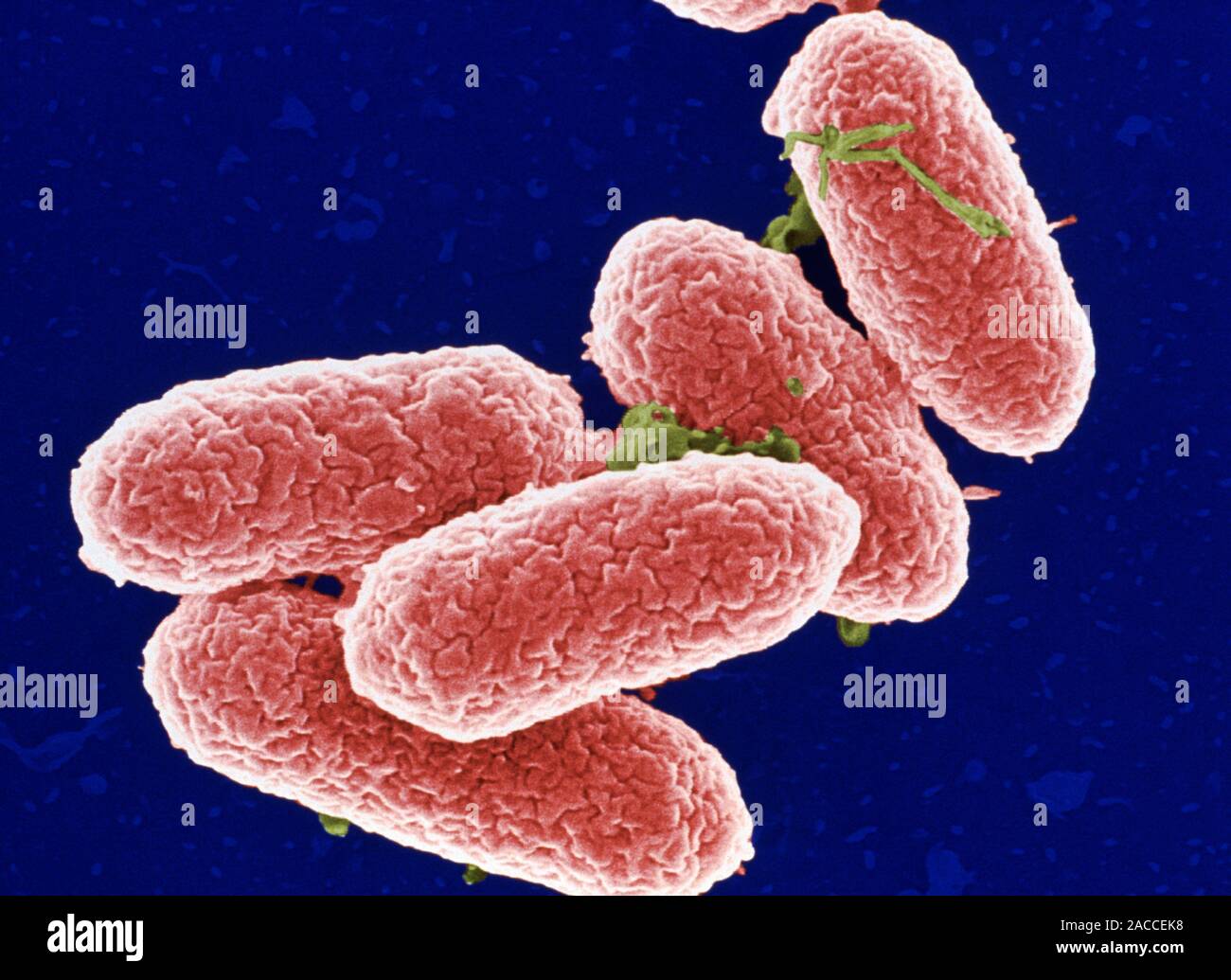 Salmonella typhimurium Bakterien. Farbige Scanning Electron Micrograph