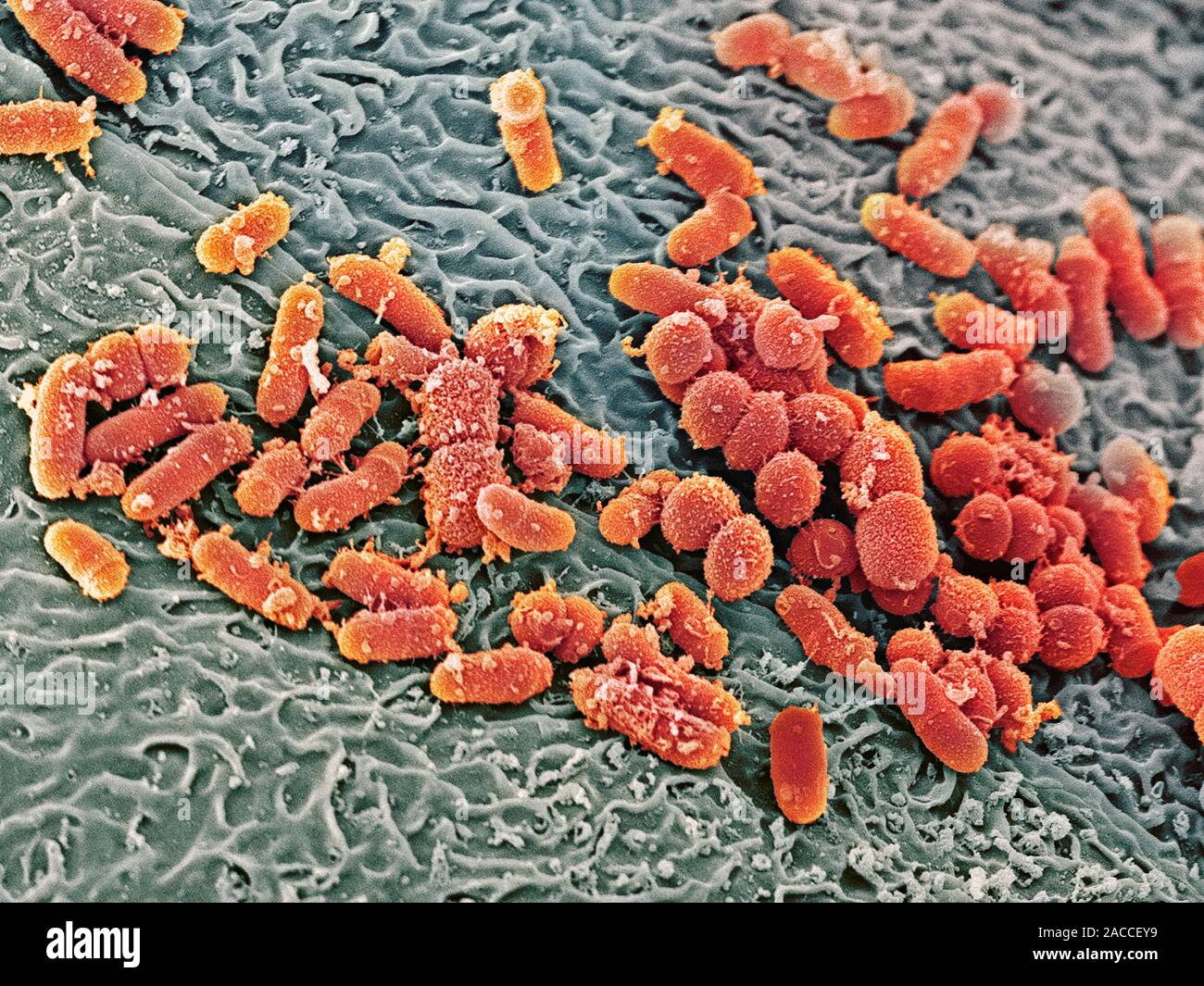 Bakterien in der Nase. Farbige Scanning Electron Micrograph (SEM) von  Bakterien (orange) auf der Oberfläche der Nasenhöhle. Schleim, durch Zellen  in abgesondert wird Stockfotografie - Alamy