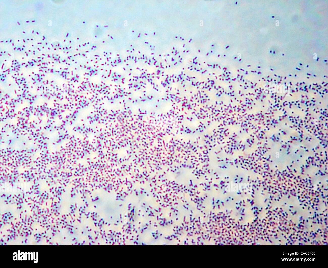 Haemophilus-influenzae-Bakterien, Licht schliffbild. Diese sind Gram-negative rod-Form (Bazillus) nicht-bewegliche Bakterien. Es gibt 2 Arten von Belastungen, en Stockfoto