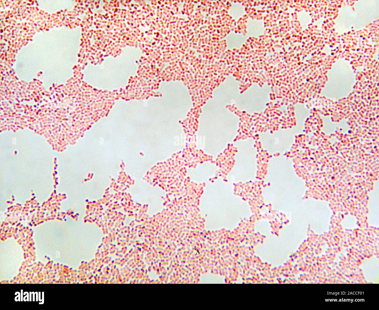 Klebsiella pneumoniae Bakterien, Licht schliffbild. Diese sind Gramnegative rodForm (Bazillus