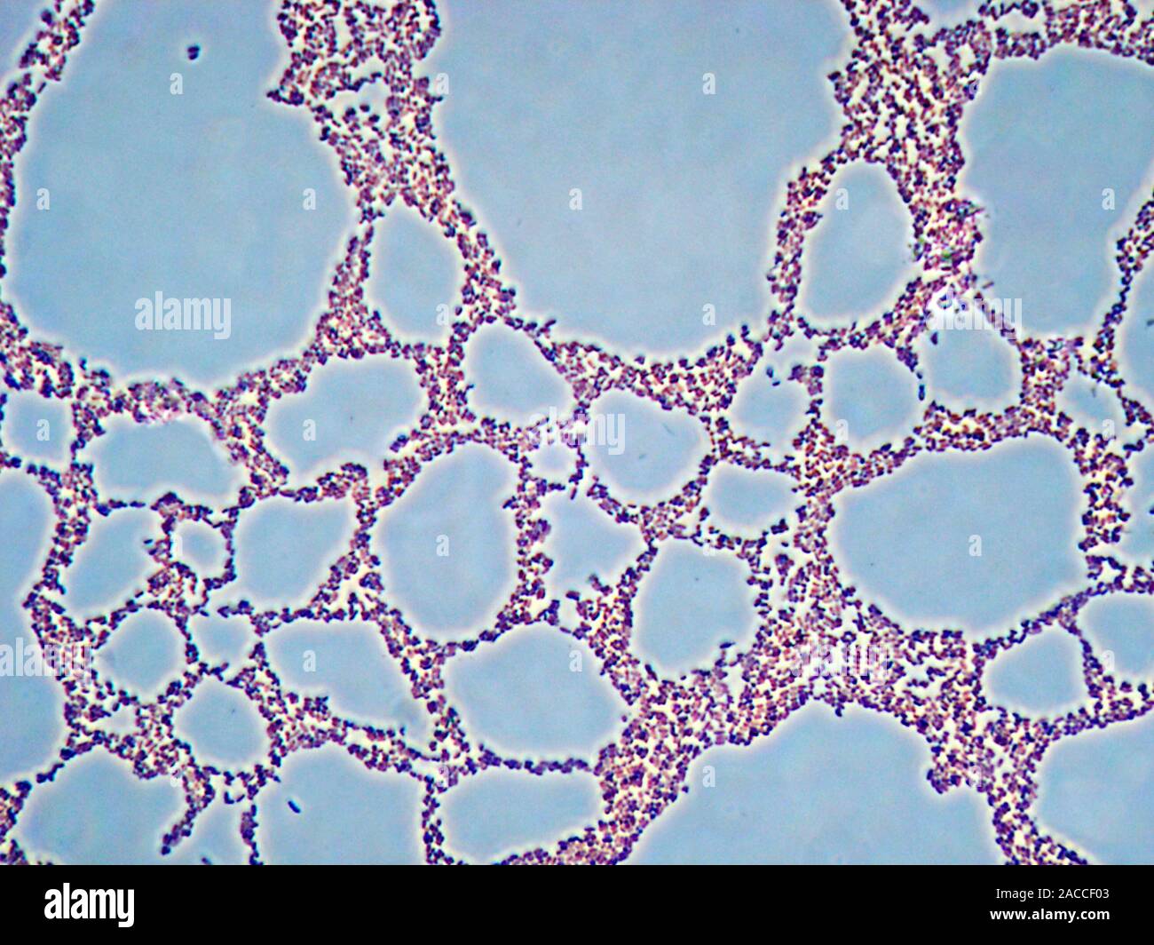 Klebsiella Pneumoniae Im Darm Erhöht www.alamy.de