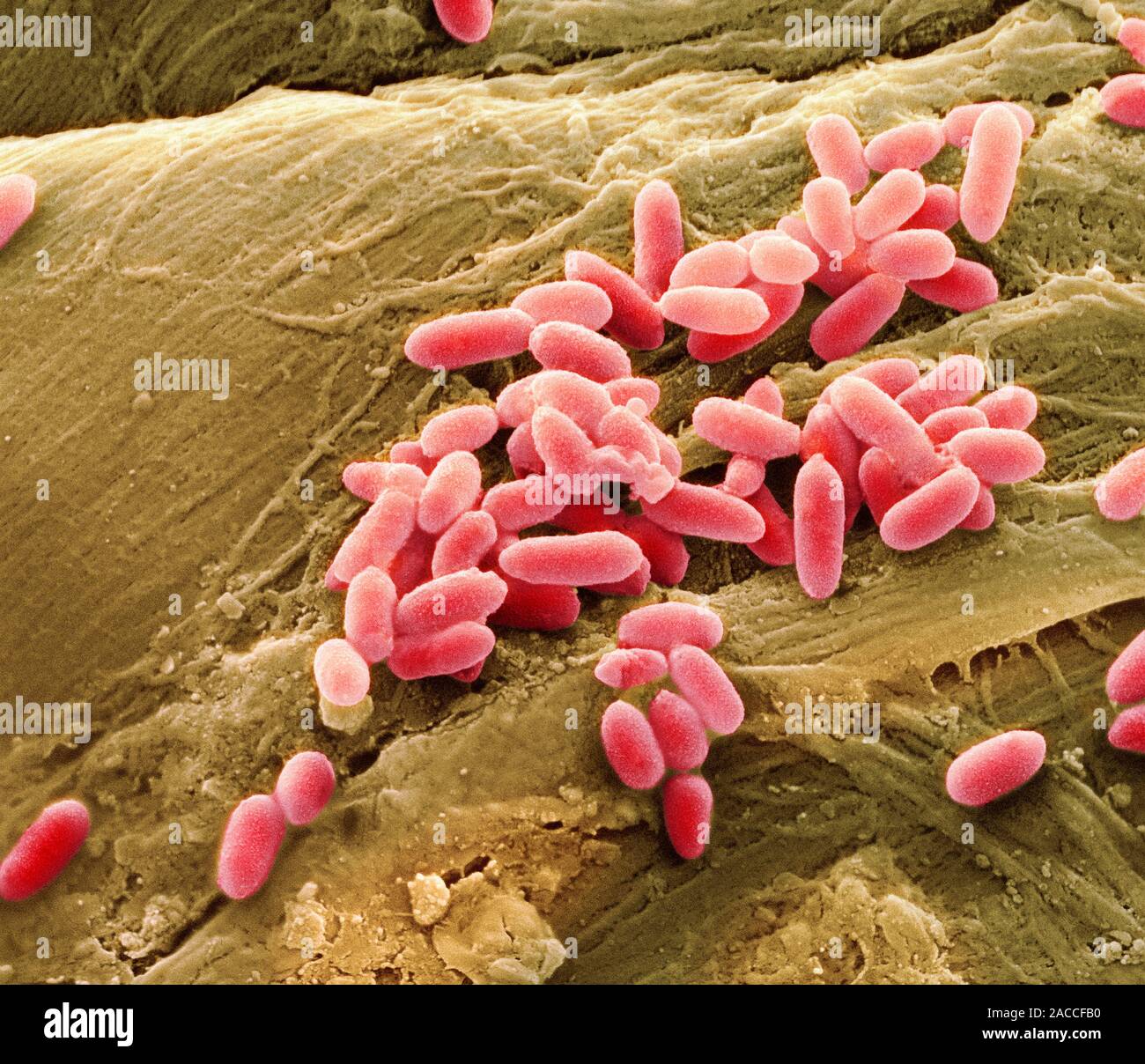 Pseudomonas aeruginosa Bakterien, farbige Scanning Electron Micrograph