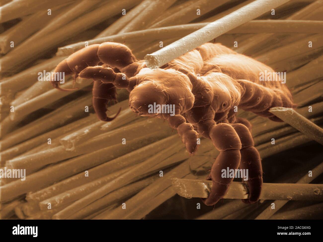 Kopflaus. Farbige Scanning Electron Micrograph (SEM) Der kopflaus