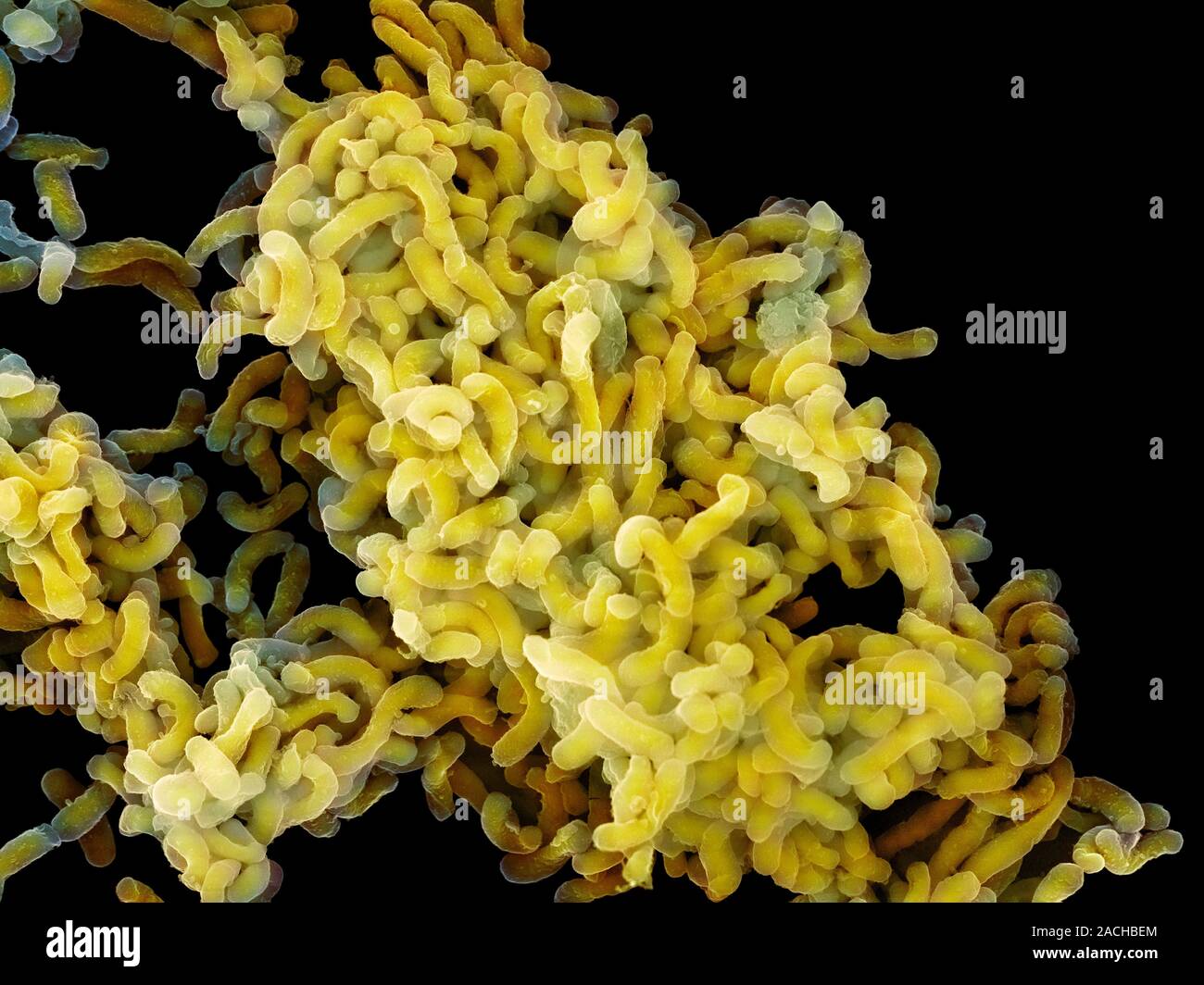 Gelber Schleim Virus Oder Bakterium www.alamy.de