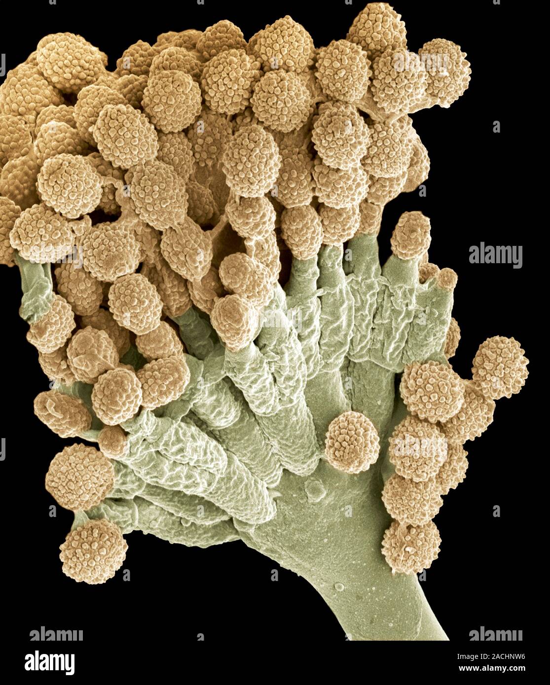 Патогенные грибы споры. Аспергилл кандида. Аспергиллус микроскопия. Грибы кандида под микроскопом. Аспергилла грибок.