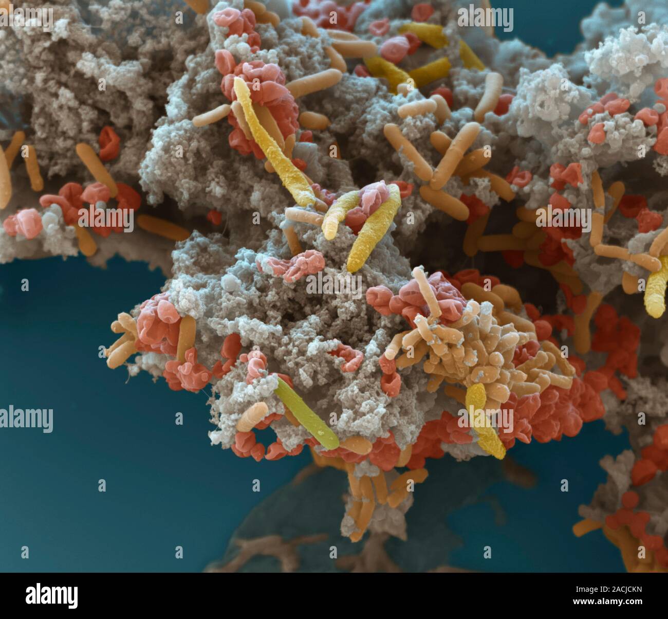 Dechlorinating Bakterien. Farbige Scanning Electron Micrograph (SEM) der Dehalococcoides sp. Bakterien (Rot) unter anderen Bakterien. Diese Bakterien obtai Stockfoto