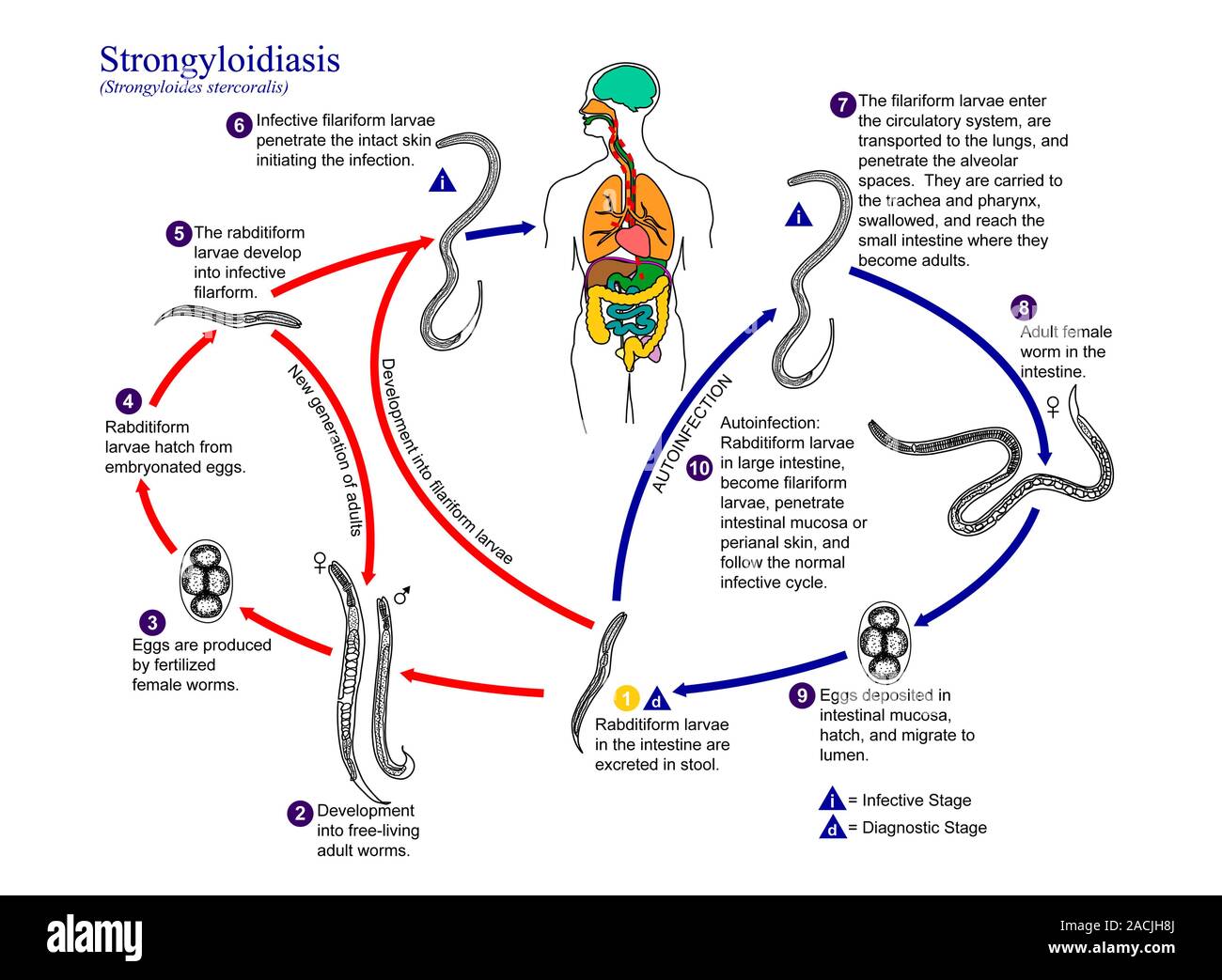 Strongyloidiasis Lebenszyklus Grafik Die Den Lebenszyklus Der Strongyloidiasis Lebenszyklus Grafik Die Den Lebenszyklus Der