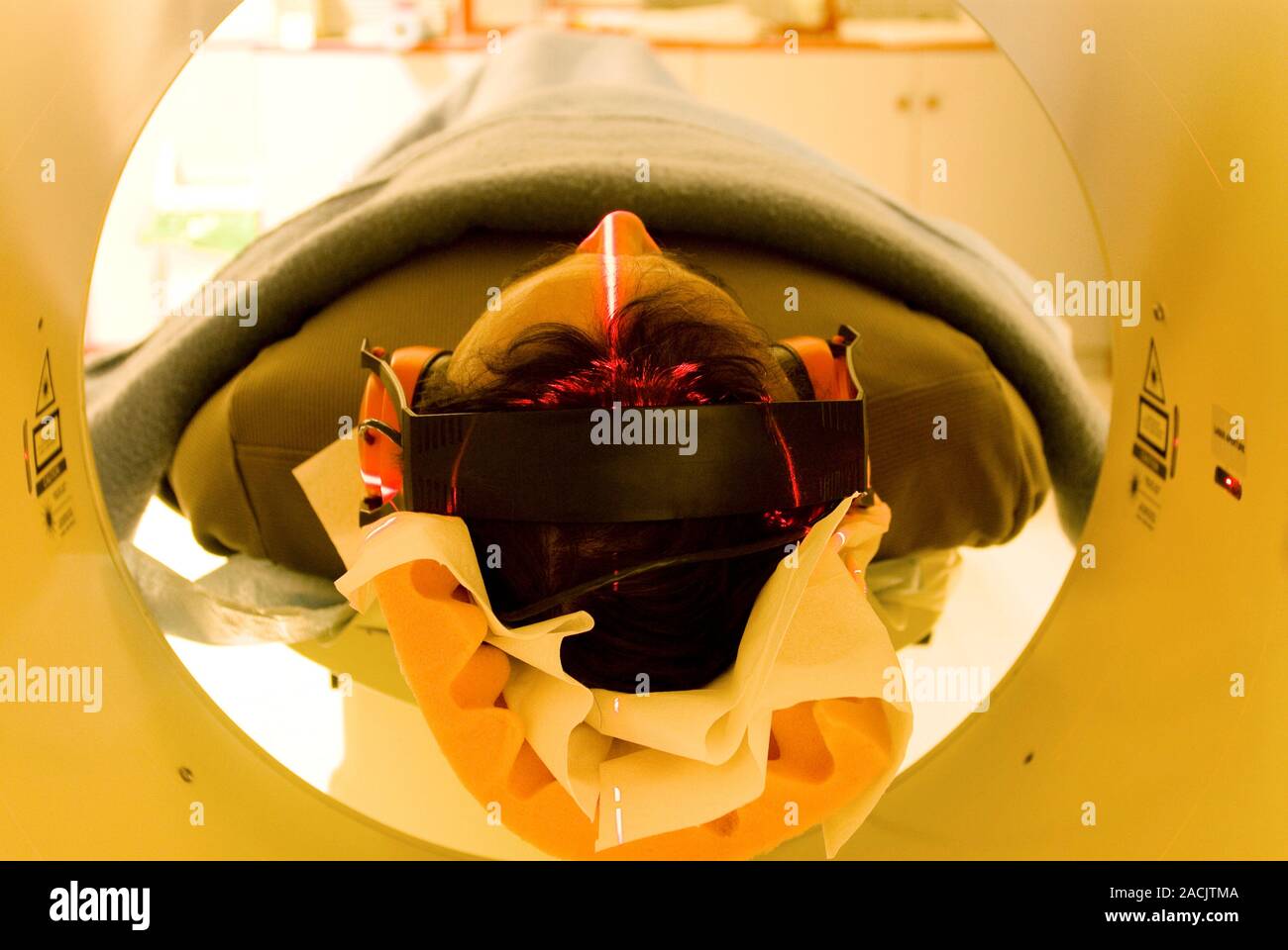 Autism Research. Menschen mit Autismus eine funktionelle Magnetresonanztomographie (fMRI) Scan seines Gehirns seine Wahrnehmung der auditorischen Stimul zu testen Stockfoto