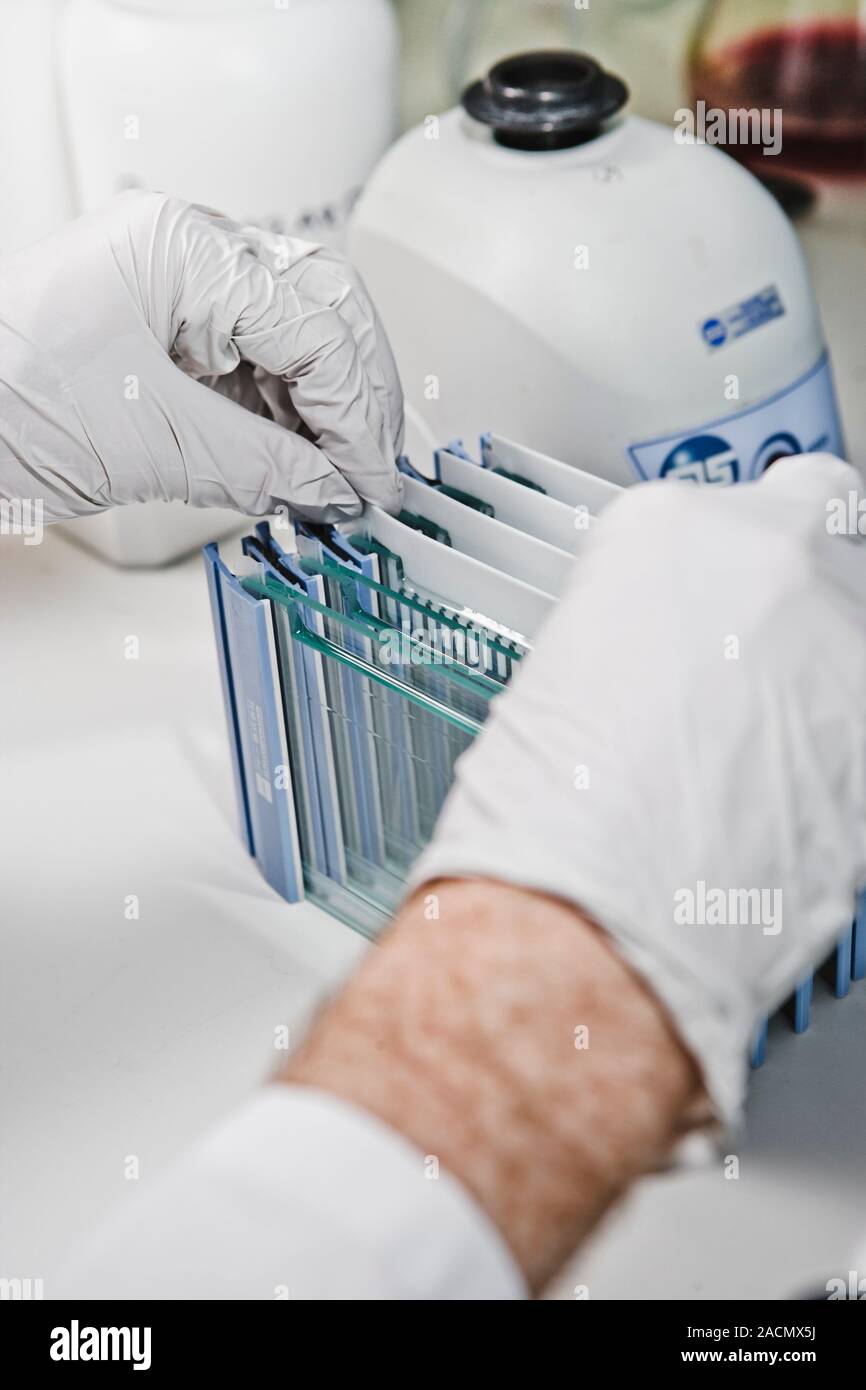 Kinase Profiling Using Kit Kinase-profiling. Forscher analysieren Proteinkinase Inhibitoren ihre ...