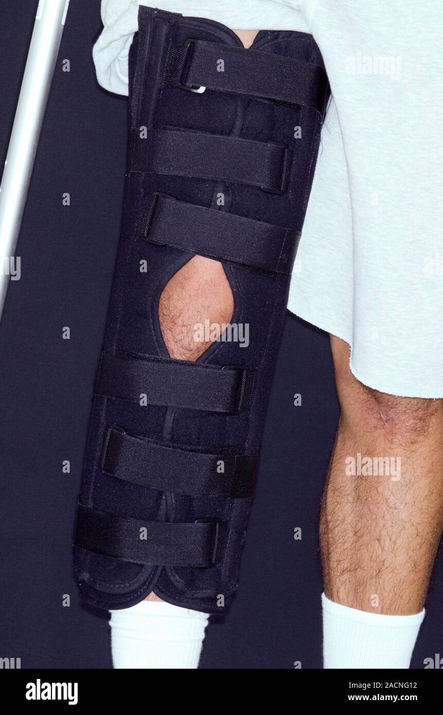 Geschwollenes Knie aufgrund einer zerrissenen medial collateral Ligament in eine 17jährige