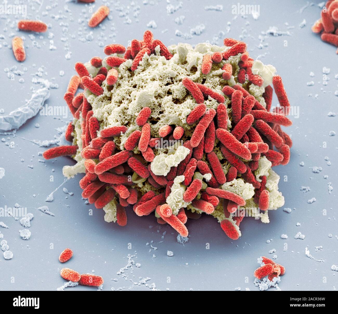 E.-coli-Bakterien. Farbige Scanning Electron Micrograph (SEM) von Escherichia-coli-Bakterien (rot) um die Überreste einer toten Zelle befestigt. E. coli Bakter Stockfoto