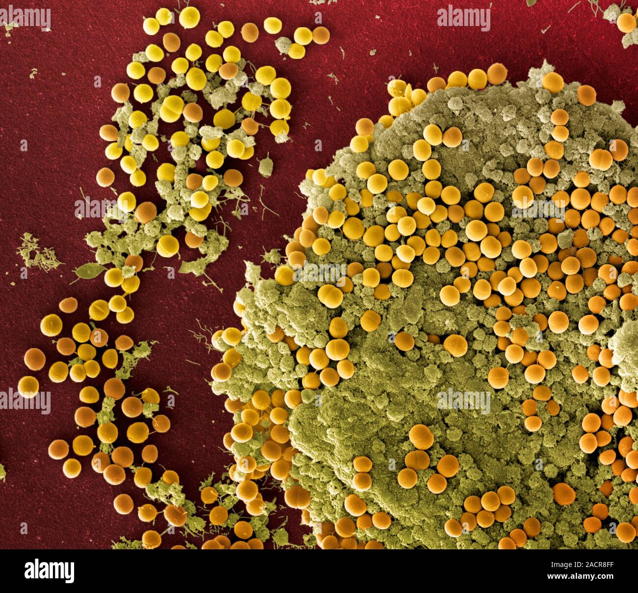Staphylococcus aureus-Bakterien, Farbig Scanning Electron Micrograph