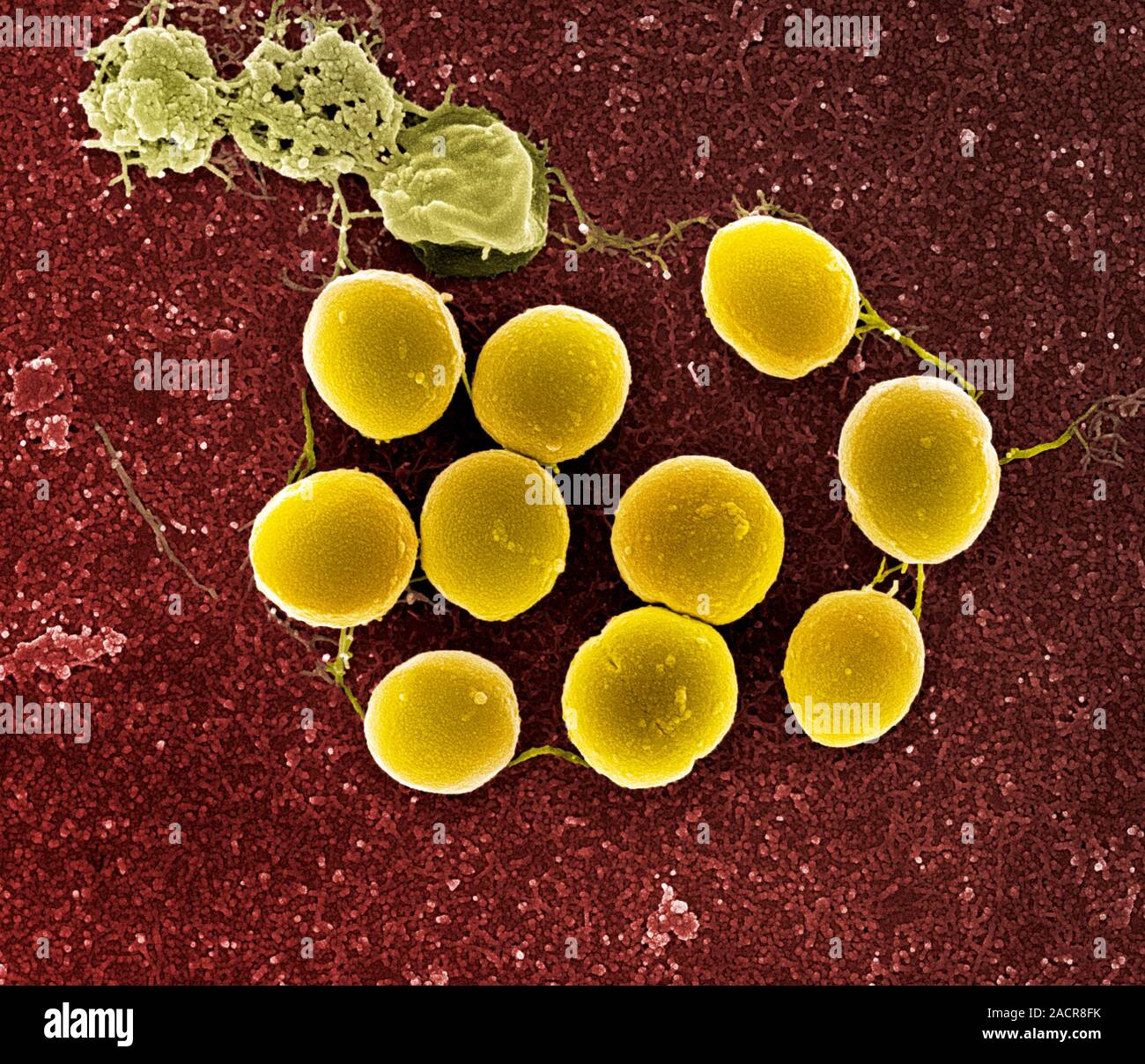Staphylococcus aureusBakterien, Farbig Scanning Electron Micrograph