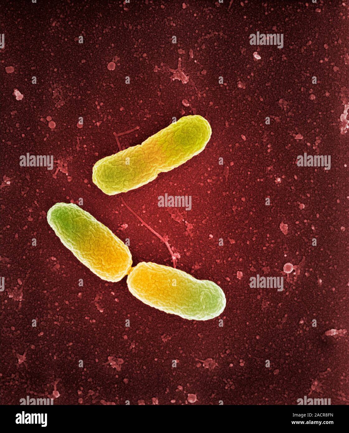 Pseudomonas aeruginosa Bakterien, farbige Scanning Electron Micrograph ...