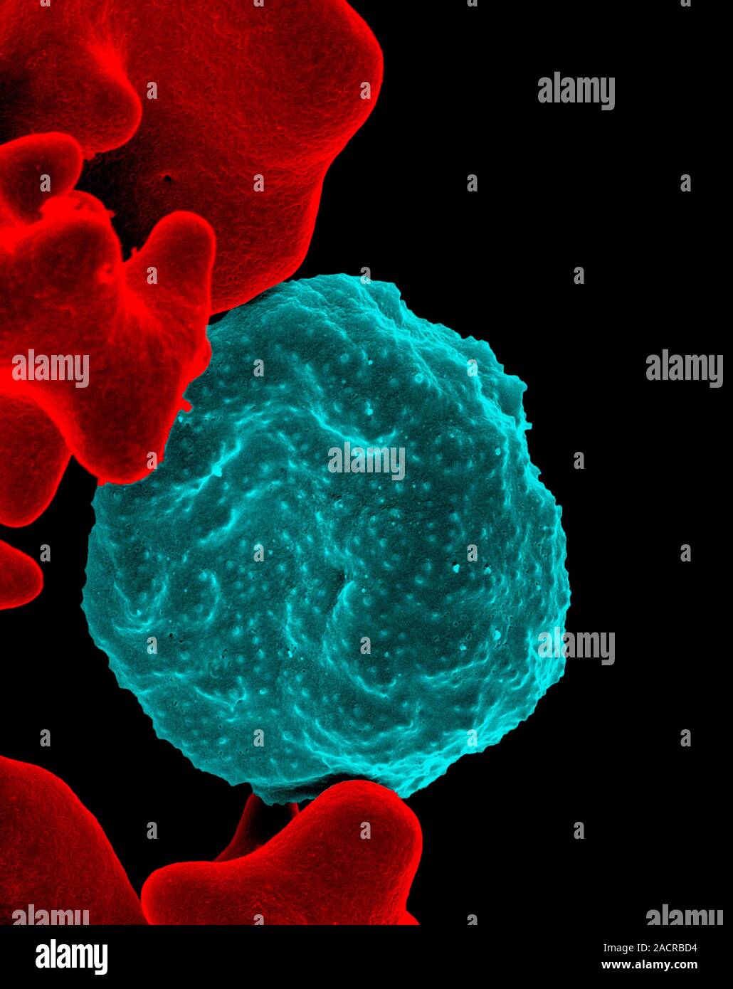 Malaria Blutzelle. Farbige Scanning Electron Micrograph (SEM) der