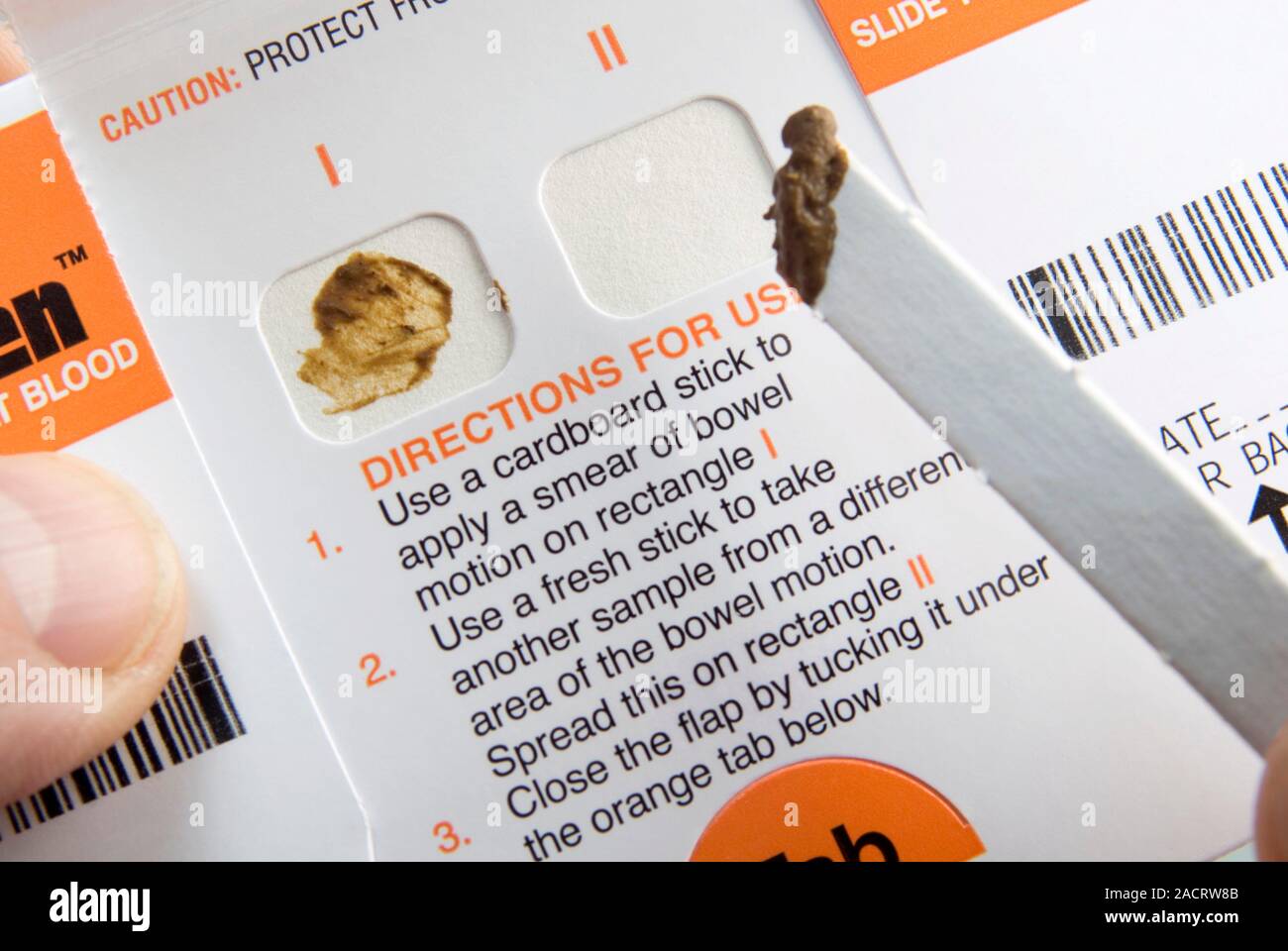 Okkultes Blut Im Stuhl Erfahrungen www.alamy.de