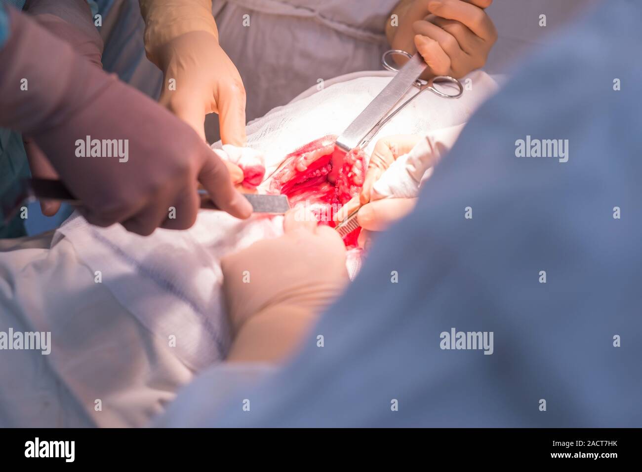 Ein Chirurg mit Assistenten, die in einem sterilen Operationssaal, ist auf die inneren Organe betrieben. Blau kalten OP-Leuchten. Die Hände des Chirurgen halten Sie die INSTRUME Stockfoto