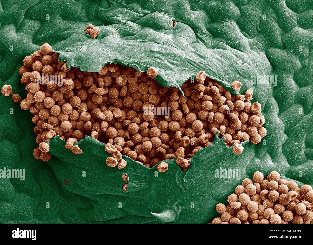 Bean Rost pustule Platzen mit ansteckenden Sporen, Farbig Scanning Electron Micrograph (SEM). Bean Rost ist eine Krankheit, die durch den Pilz Urom Stockfoto