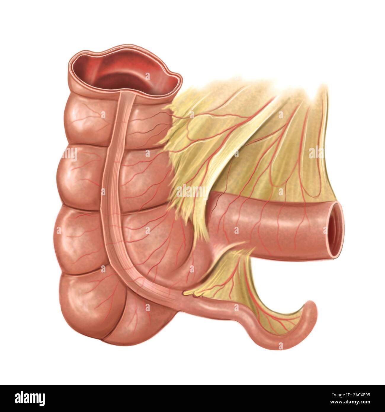 Abbildung vermiform appendix und die angrenzenden strukturen diese