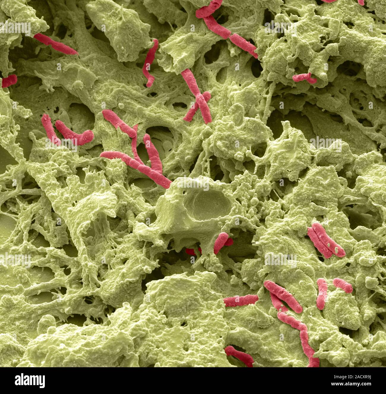 Farbige Scanning Electron Micrograph (SEM) Pseudomonas aeruginosa