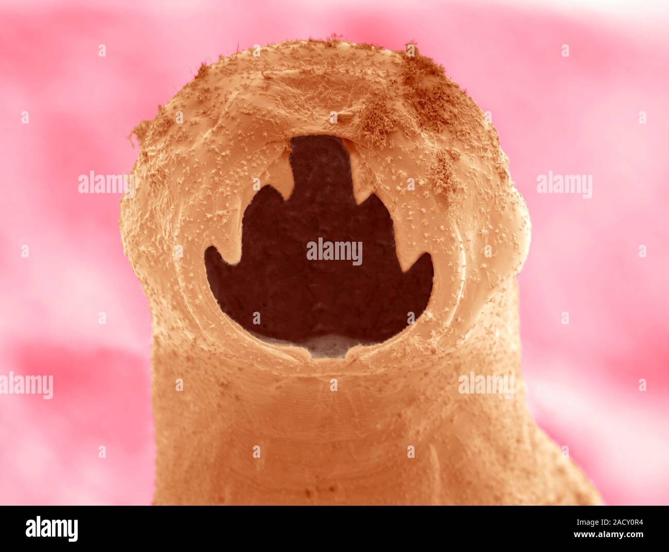 Hookworm, farbige Environmental Scanning Electron Micrograph (ESEM