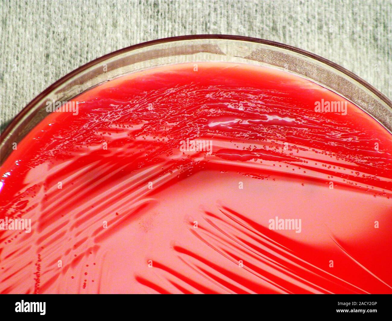 Pseudomonas fluorescens Bakterien Kultur. Petrischale mit Blut der