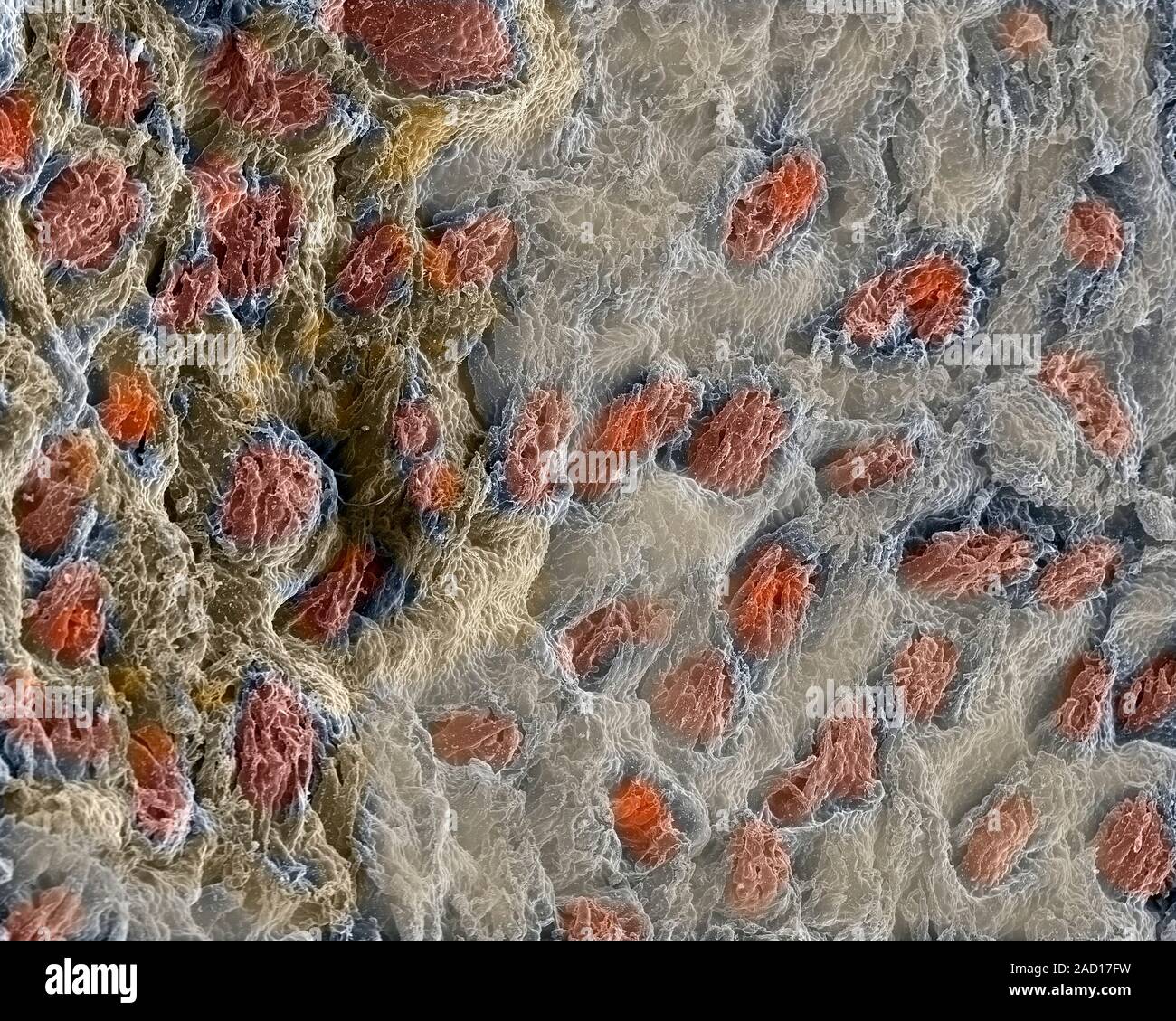 Menschliche Zunge. Scanning Electron Micrograph (SEM) der Oberfläche