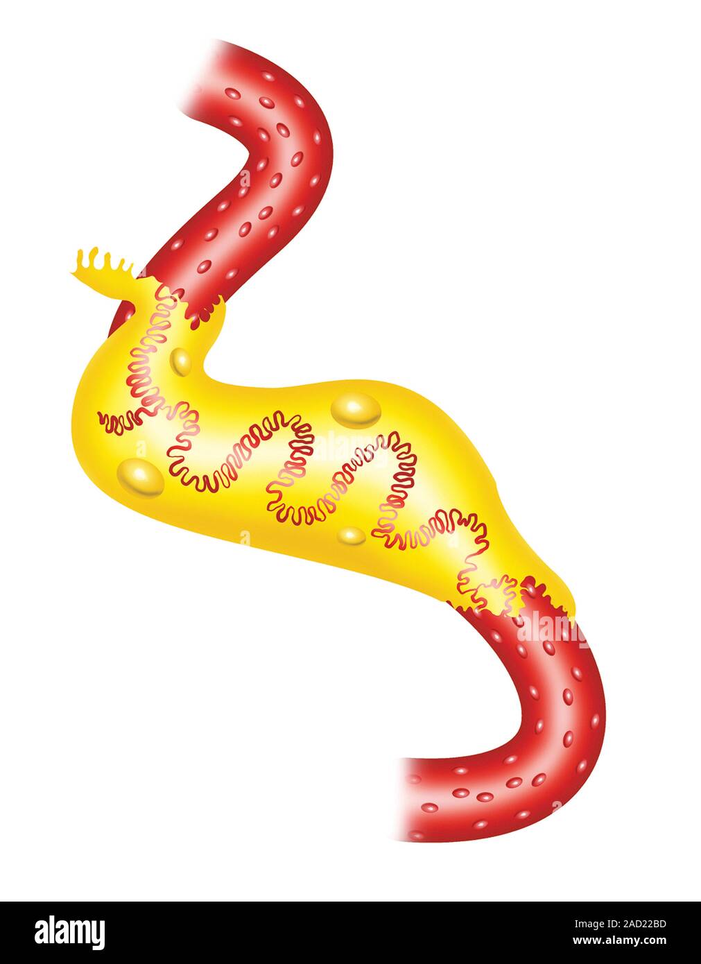 Abbildung die glomeruläre Kapsel. Diese Abbildung ist von Asklepios