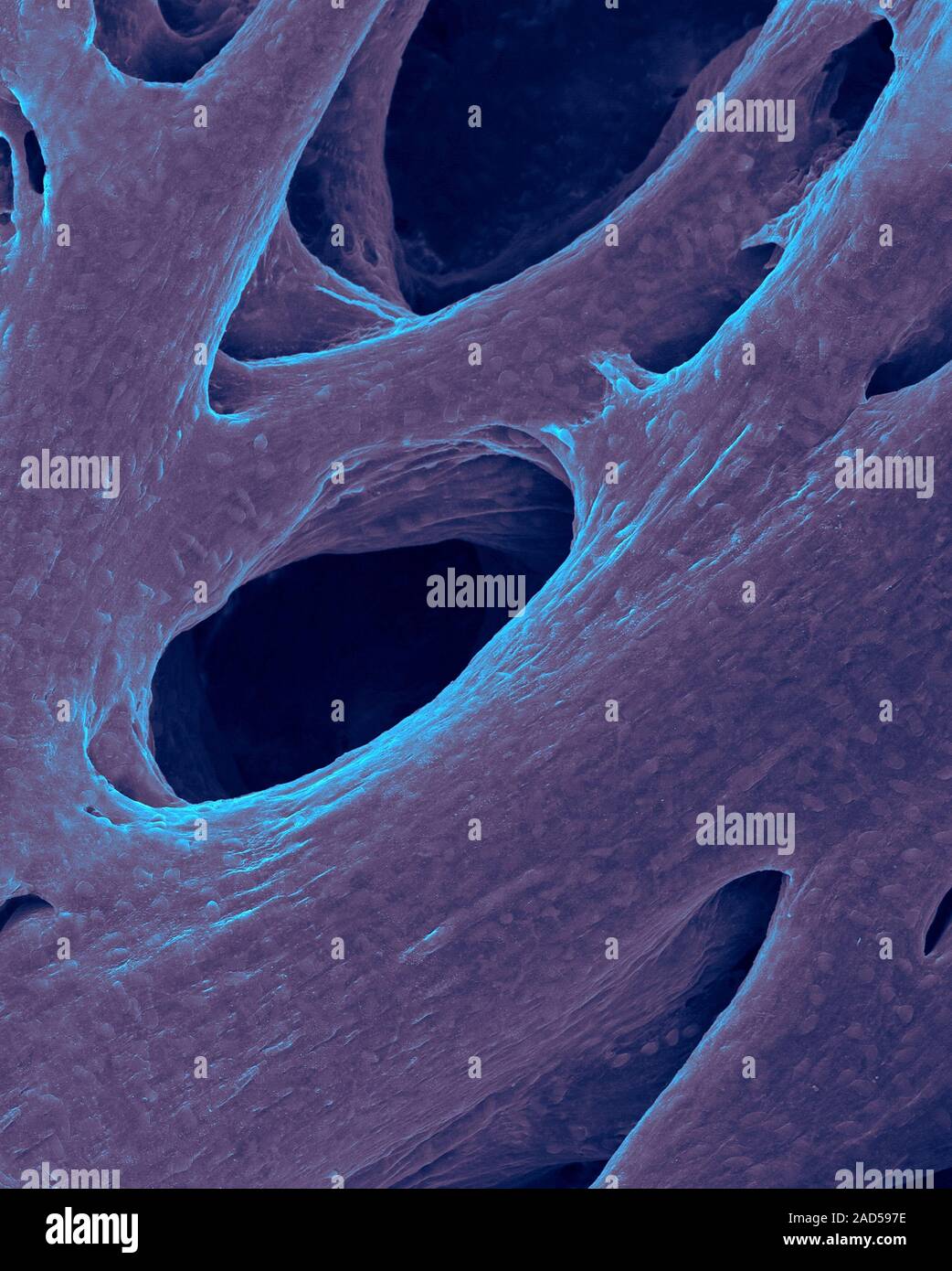 Herz Atrium (Herz) Muskel Bundles (Säugetier), farbige Scanning