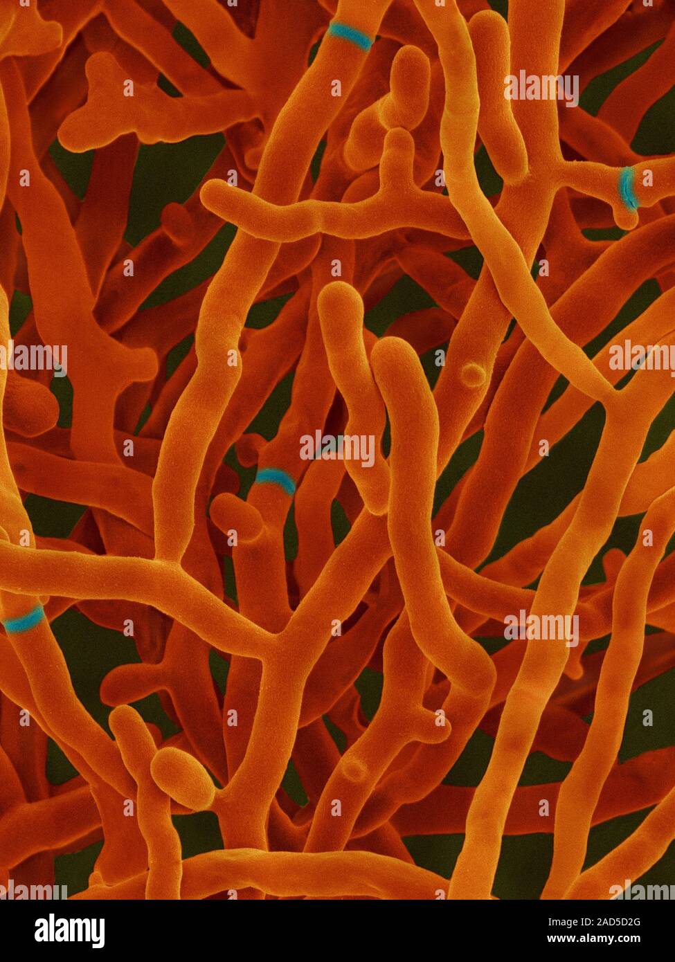 Farbige Scanning Electron Micrograph (SEM) von Streptomyces