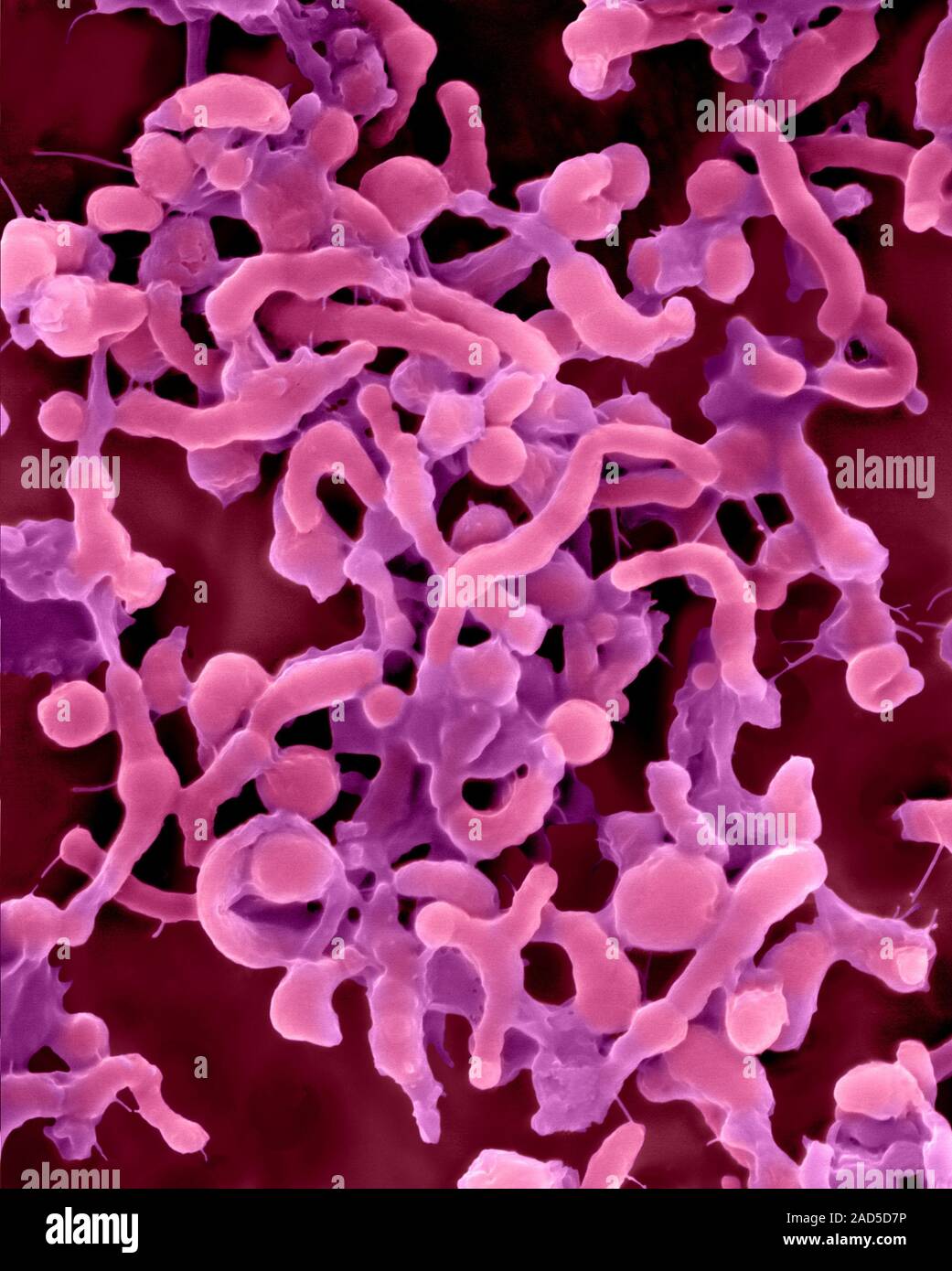 Sem Stab Label Farbige Scanning Electron Micrograph (SEM) von Helicobacter pylori ...