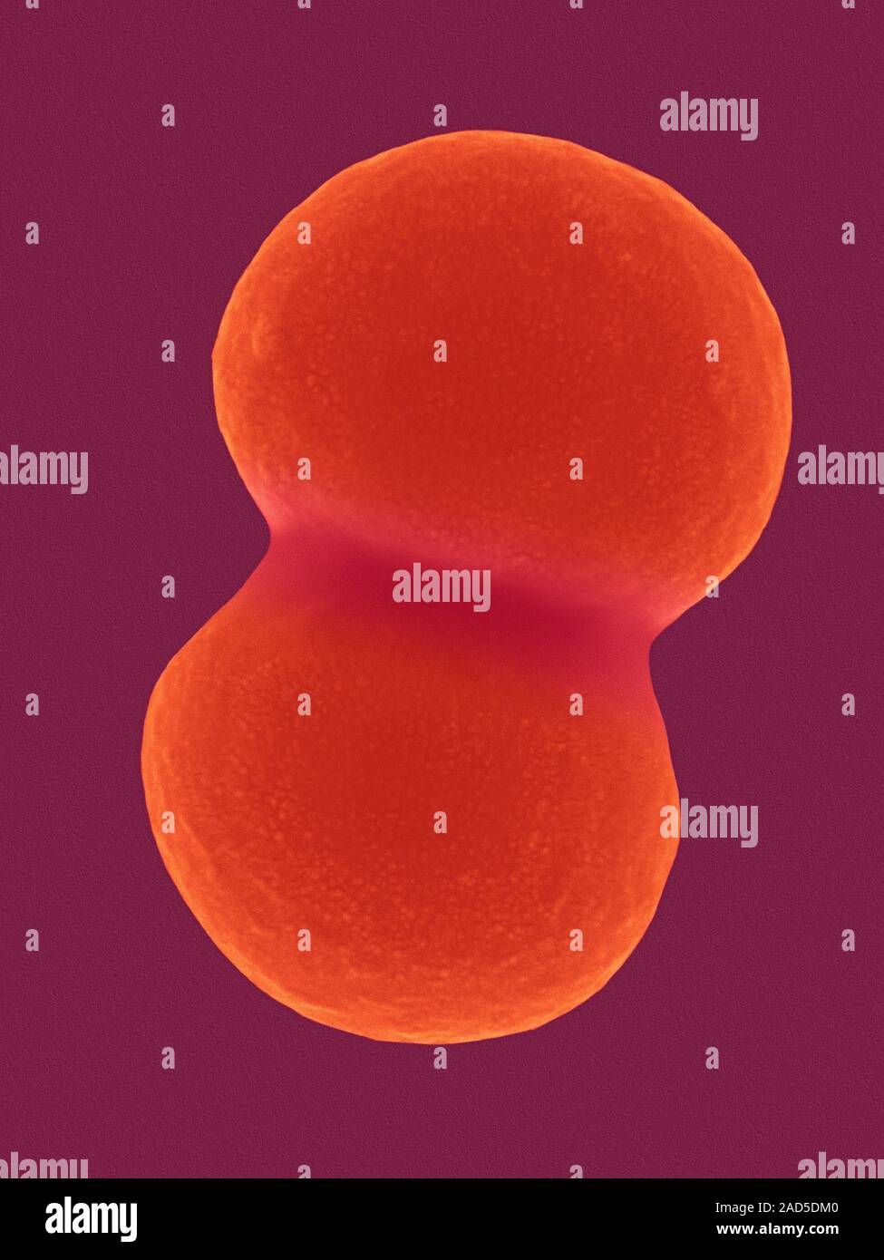 Farbige Scanning Electron Micrograph (SEM) von Staphylococcus aureus