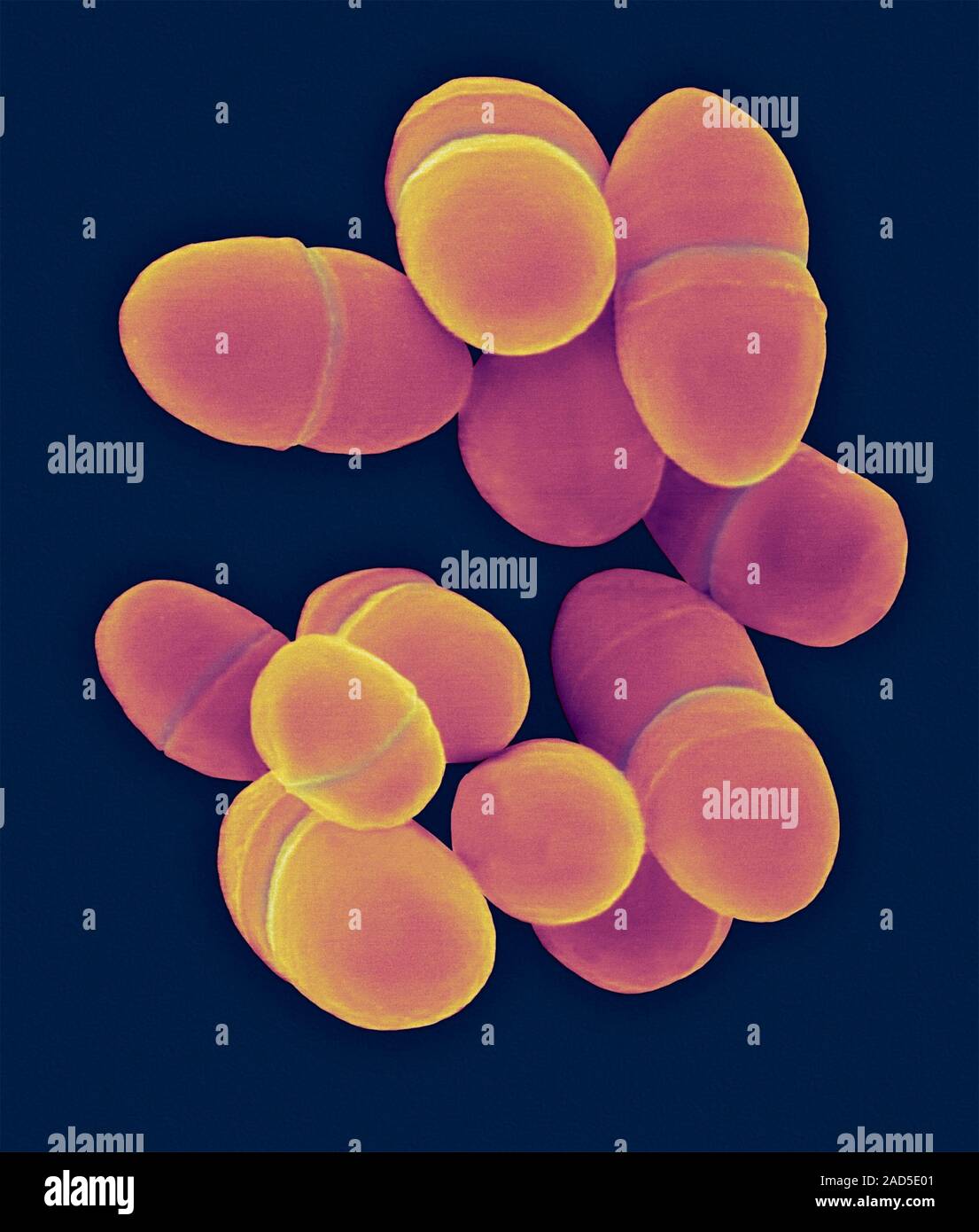 лактококки и стрептококки. термофилус стрептококк. штамм lactococcus lactis. термофильный молочнокислый стрептококк. стрептококк мутанс микробиология.