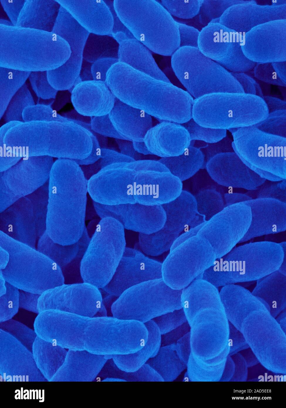 Farbige Scanning Electron Micrograph (SEM) von Sphingomonas