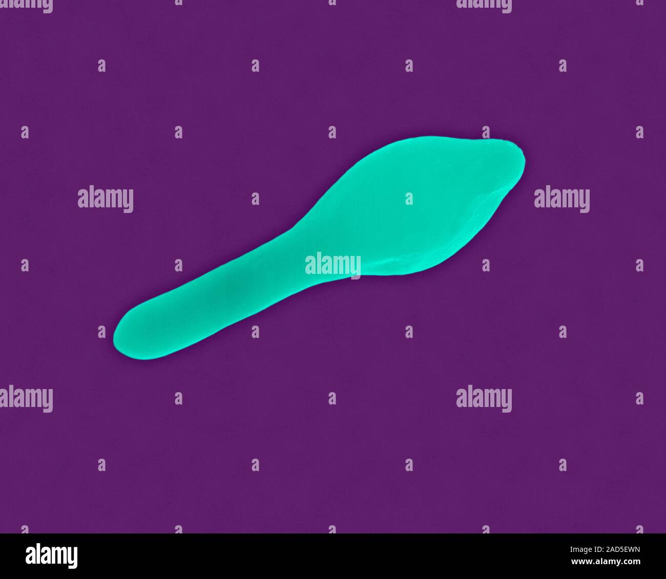 Farbige Scanning Electron Micrograph (SEM) von Clostridium botulinum