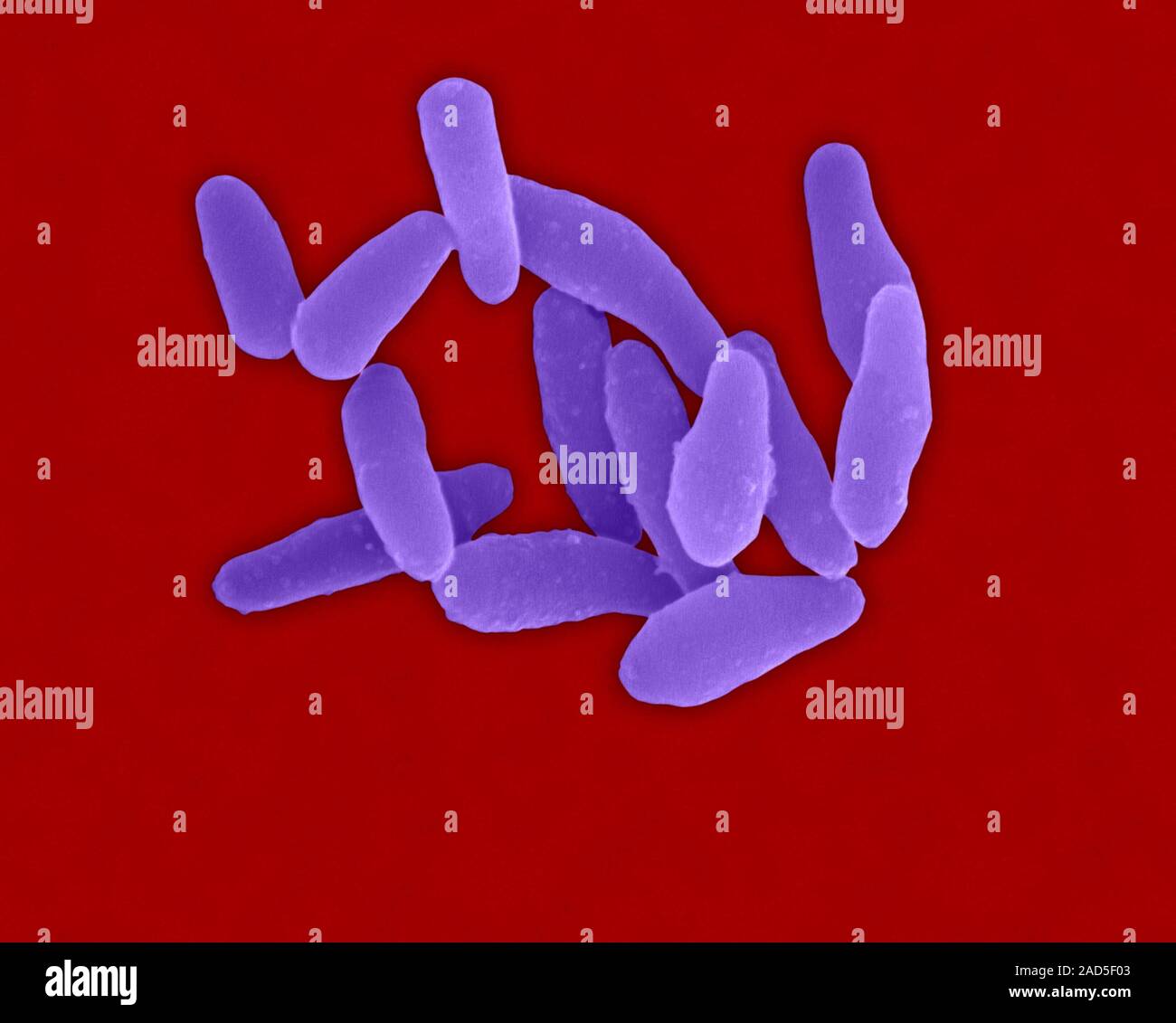 Farbige Scanning Electron Micrograph (SEM) von Corynebacterium