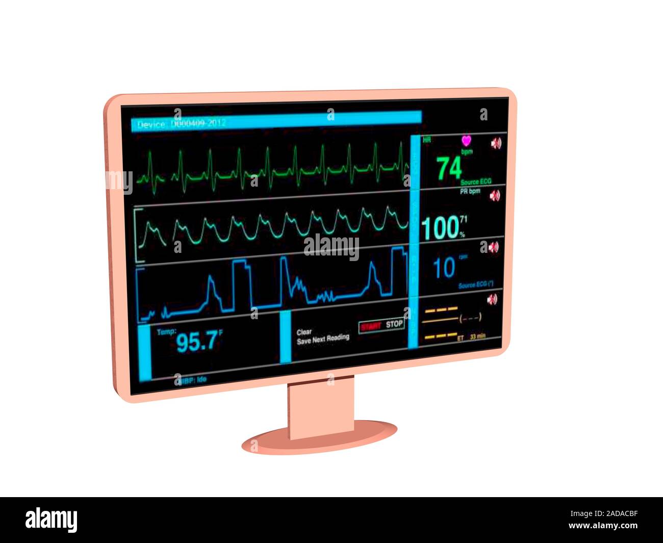 Monitor zur Überwachung der Vitalparameter im Krankenhaus Stockfoto