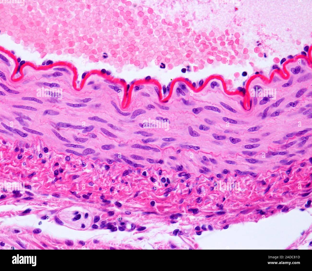 Licht Schliffbild mit den Layern eines muskulösen Arterie. Es gesehen