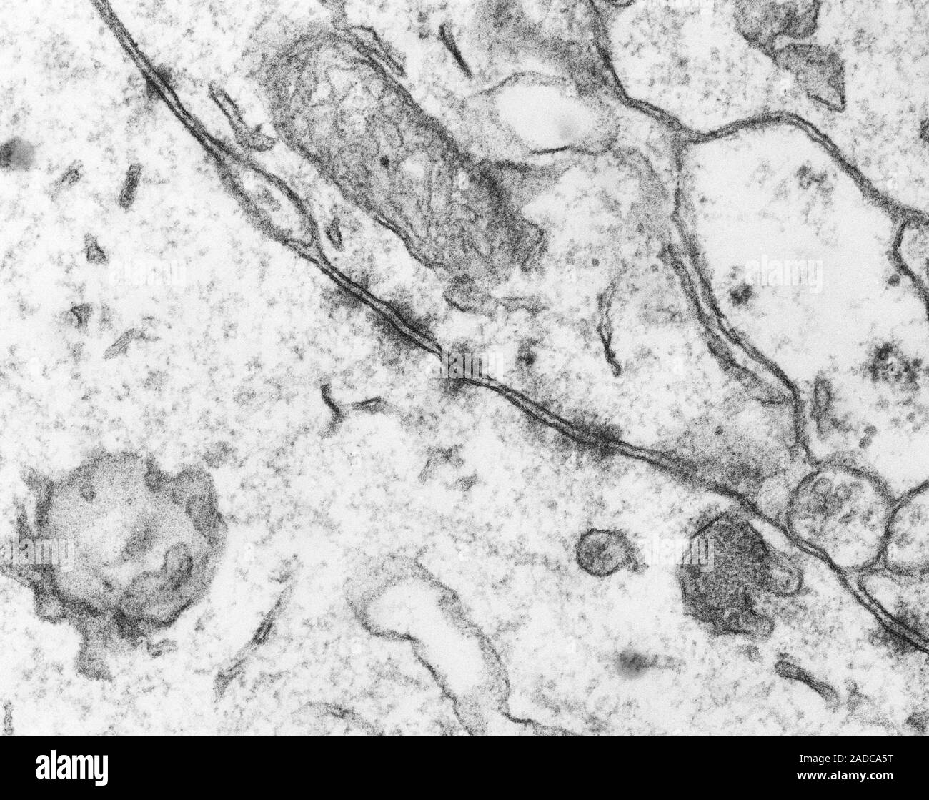 Zonula Adherens Junctions (Zelle) zwischen Neuronen (zentrales
