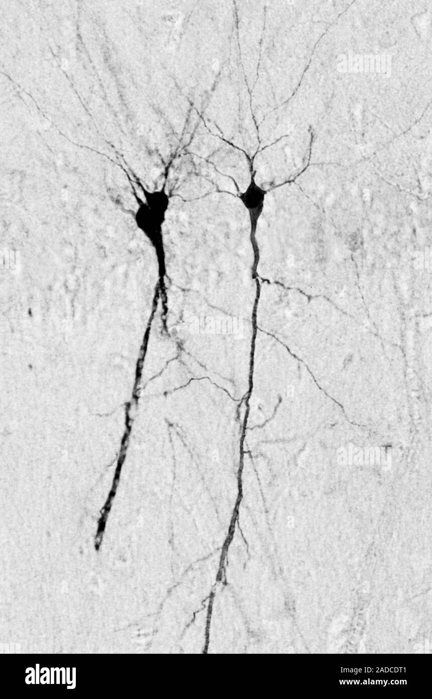 Hellfeld leichte Aufnahme von Pyramidalen pyramidenförmigen Neuronen