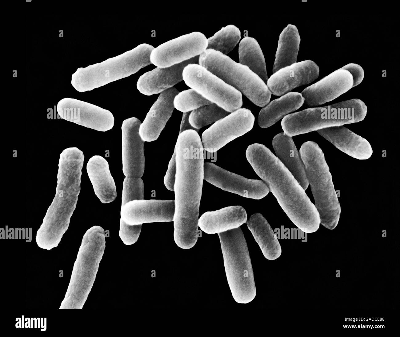 Коккобациллы что это. Legionella pneumophila микроскопия. Бордетеллы легионеллы. Бацилла ларве. Бацилла параальвей.