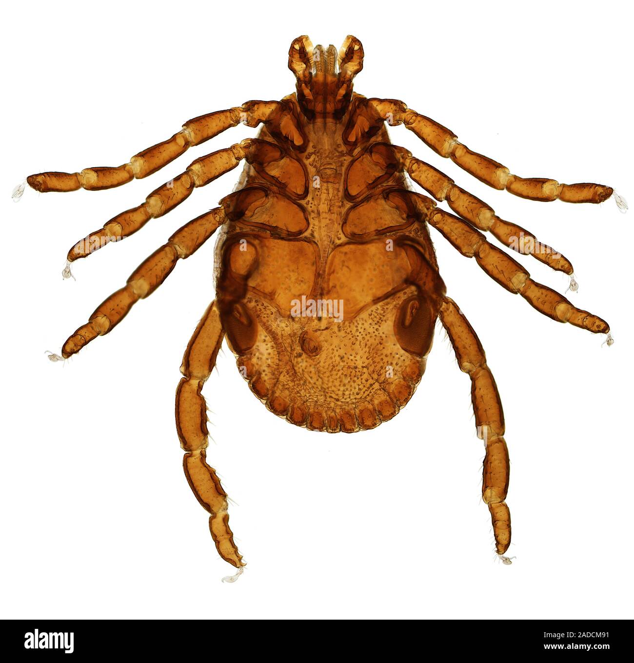 Variabilis American dog Tick (Dermacentor variabilis). Licht Schliffbild (LM) aus ...