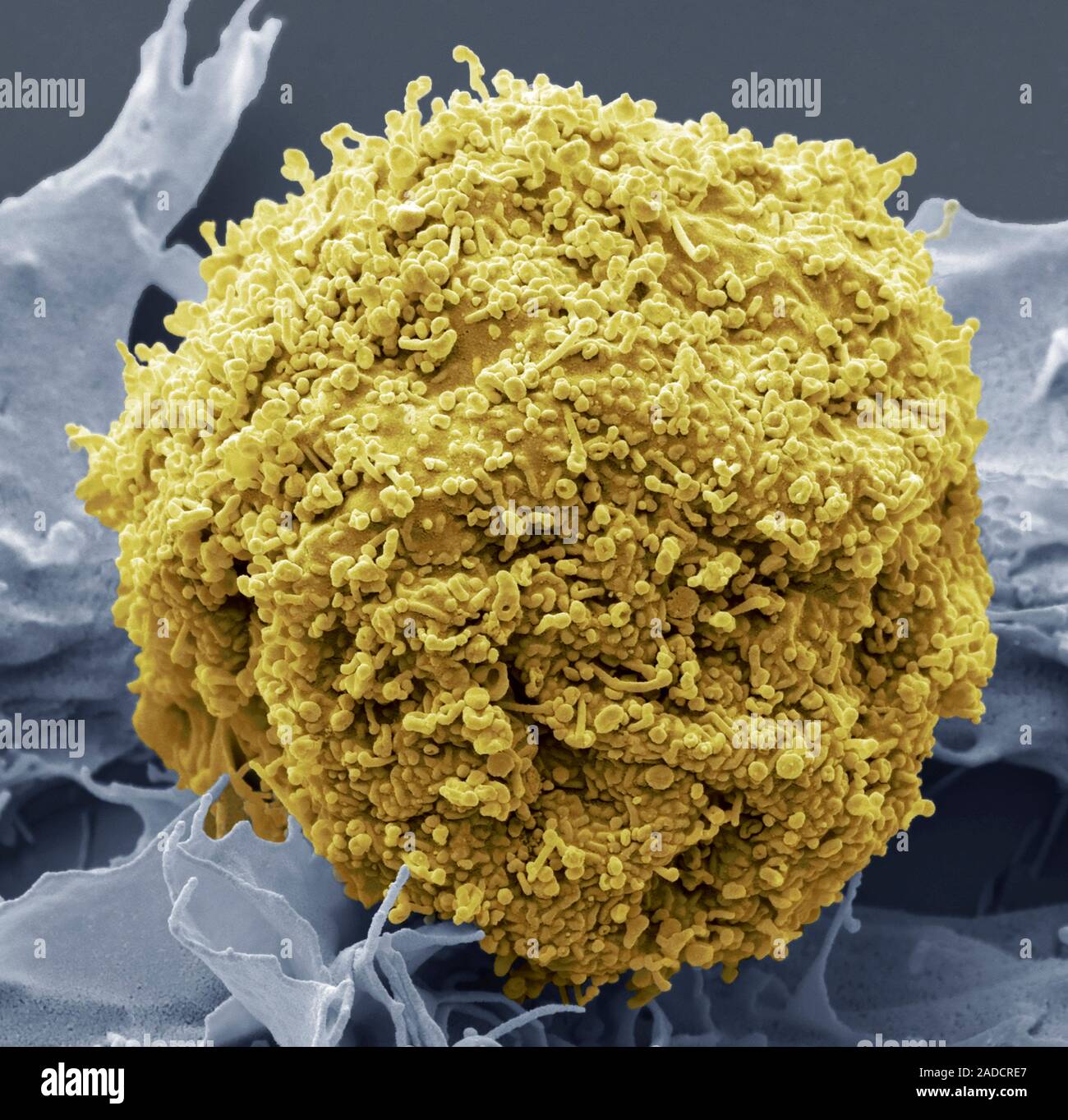 Exosomen. Farbige Scanning Electron Micrograph (SEM) eines kultivierten