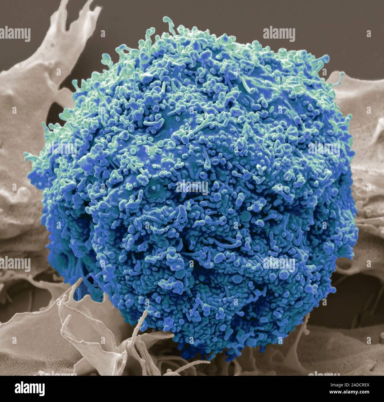 Exosomen Exosomen. Farbige Scanning Electron Micrograph (SEM) eines kultivierten ...