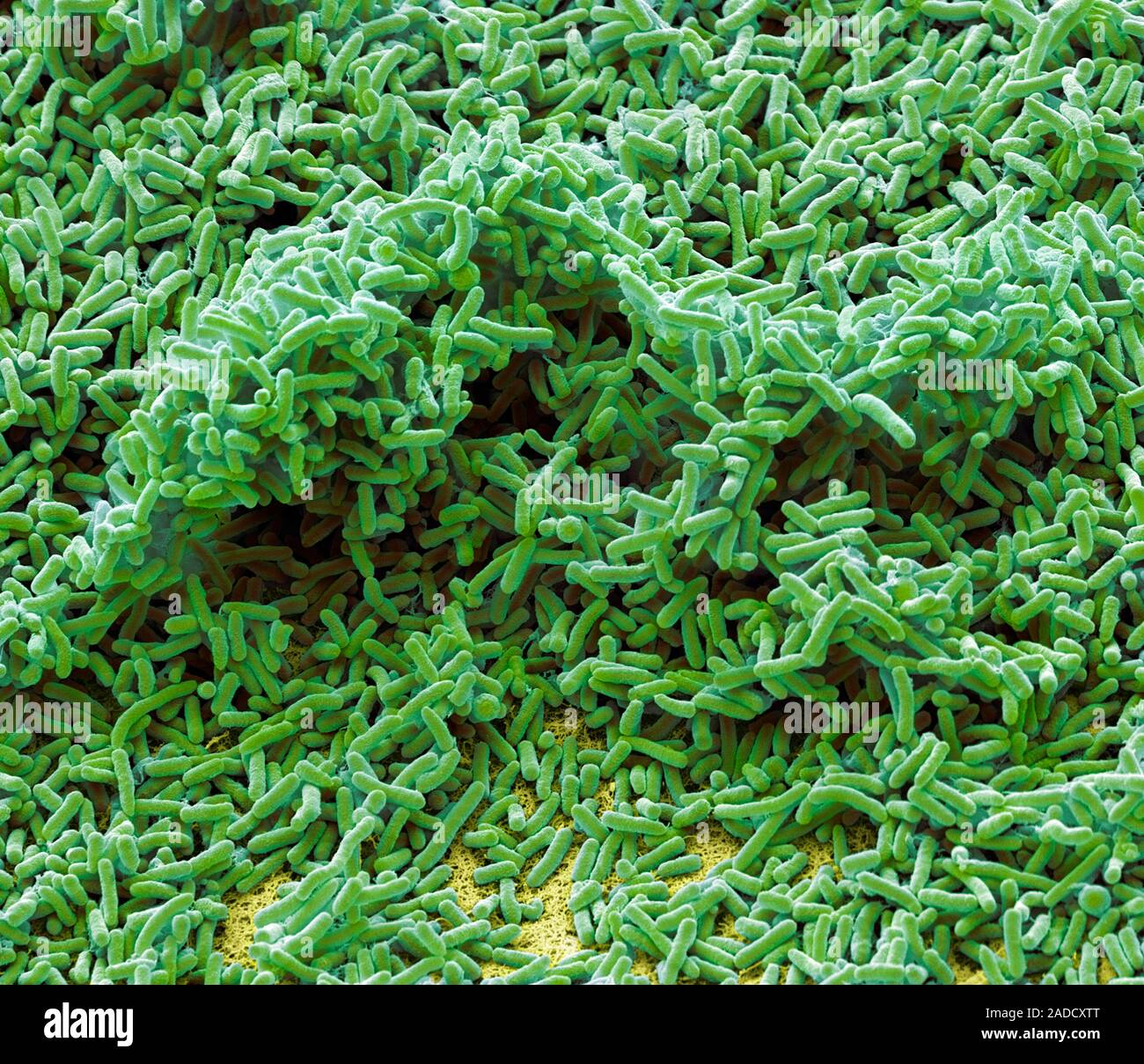 Pseudomonas Bakterien. Farbige Scanning Electron Micrograph (SEM) von