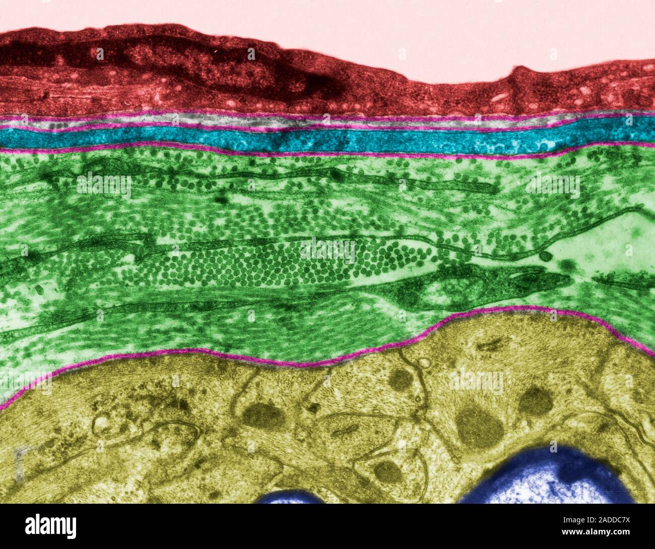 Farbige Transmission Electron Micrograph (TEM) Zeigt die Gliazellen Begrenzung der Membran (glia limitans) der weißen Substanz. Es ist von astrocyte Prozess gebildet Stockfoto