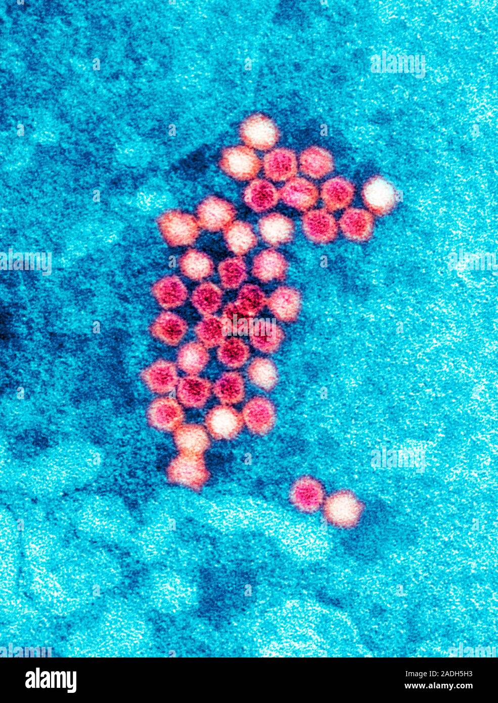 Menschliche bocavirus Partikel, farbige Transmission Electron