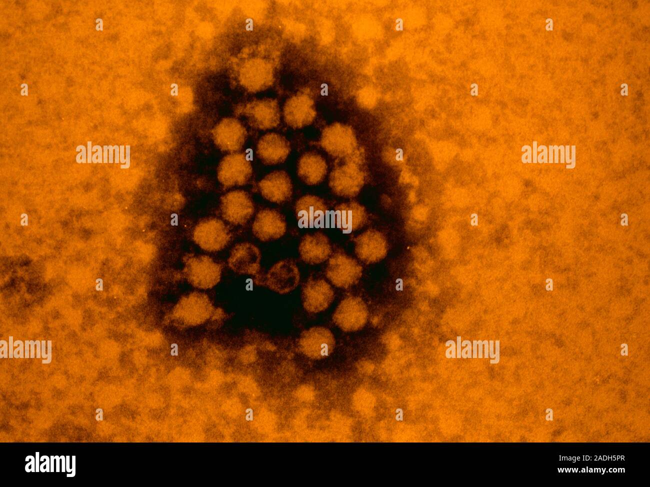 Ist Eine Erkältung Ein Virus www.alamy.de