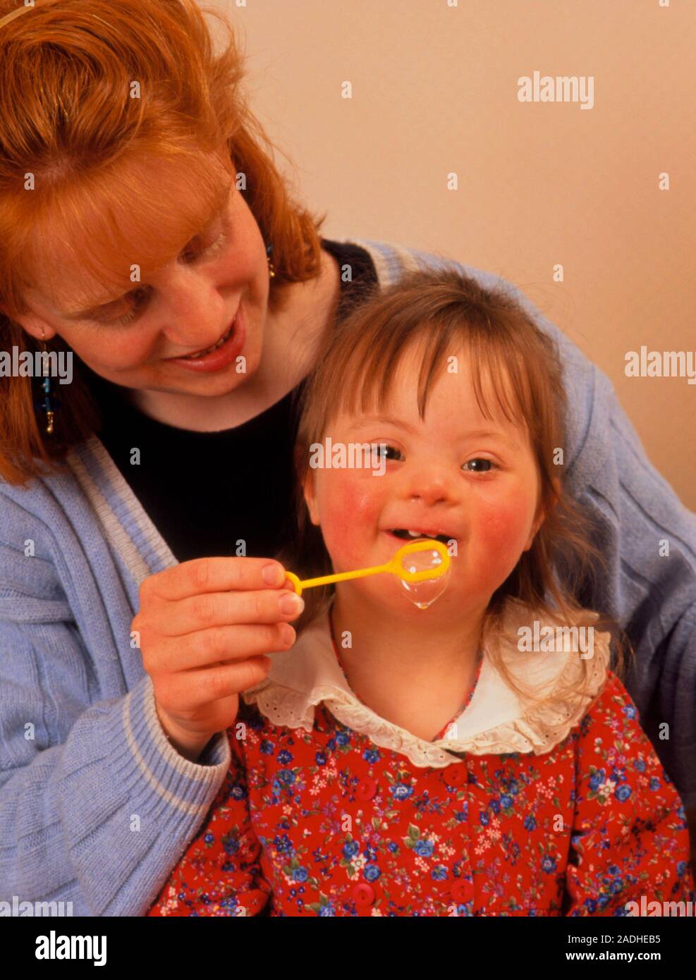 Das Downsyndrom. Ein drei Jahre altes Mädchen mit Downsyndrom (Trisomie 21) Blasen Blasen mit