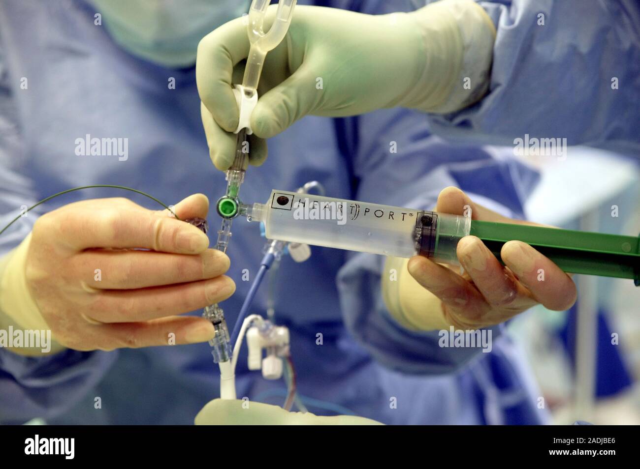 Herzklappe Chirurgie. Spritze benutzt, Kochsalzlösung in Katheter ...